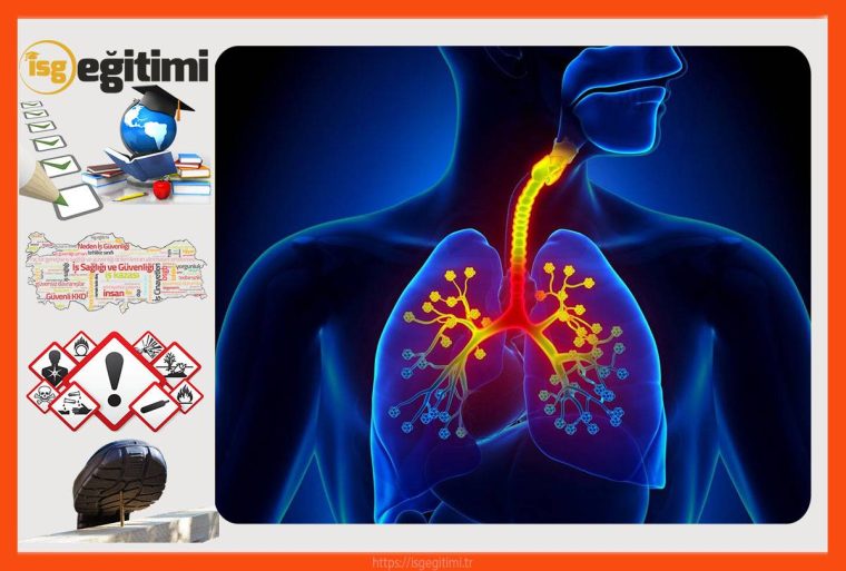 Meslek Hastalıkları